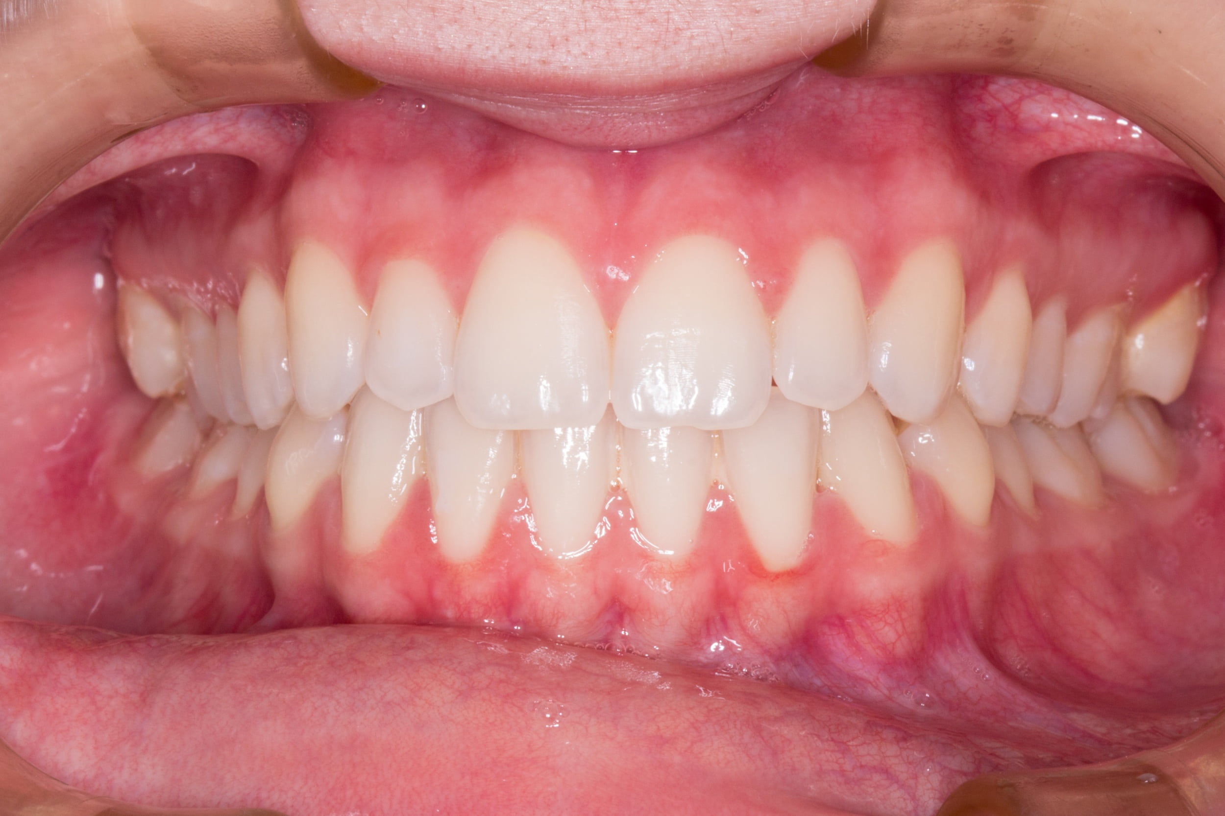 one woman only, women, human face, beautiful woman, person, 1080P, lipstick, dentist, smile, smiling, one person, happiness, adult, teeth, make-up, human lips, HD Wallpaper