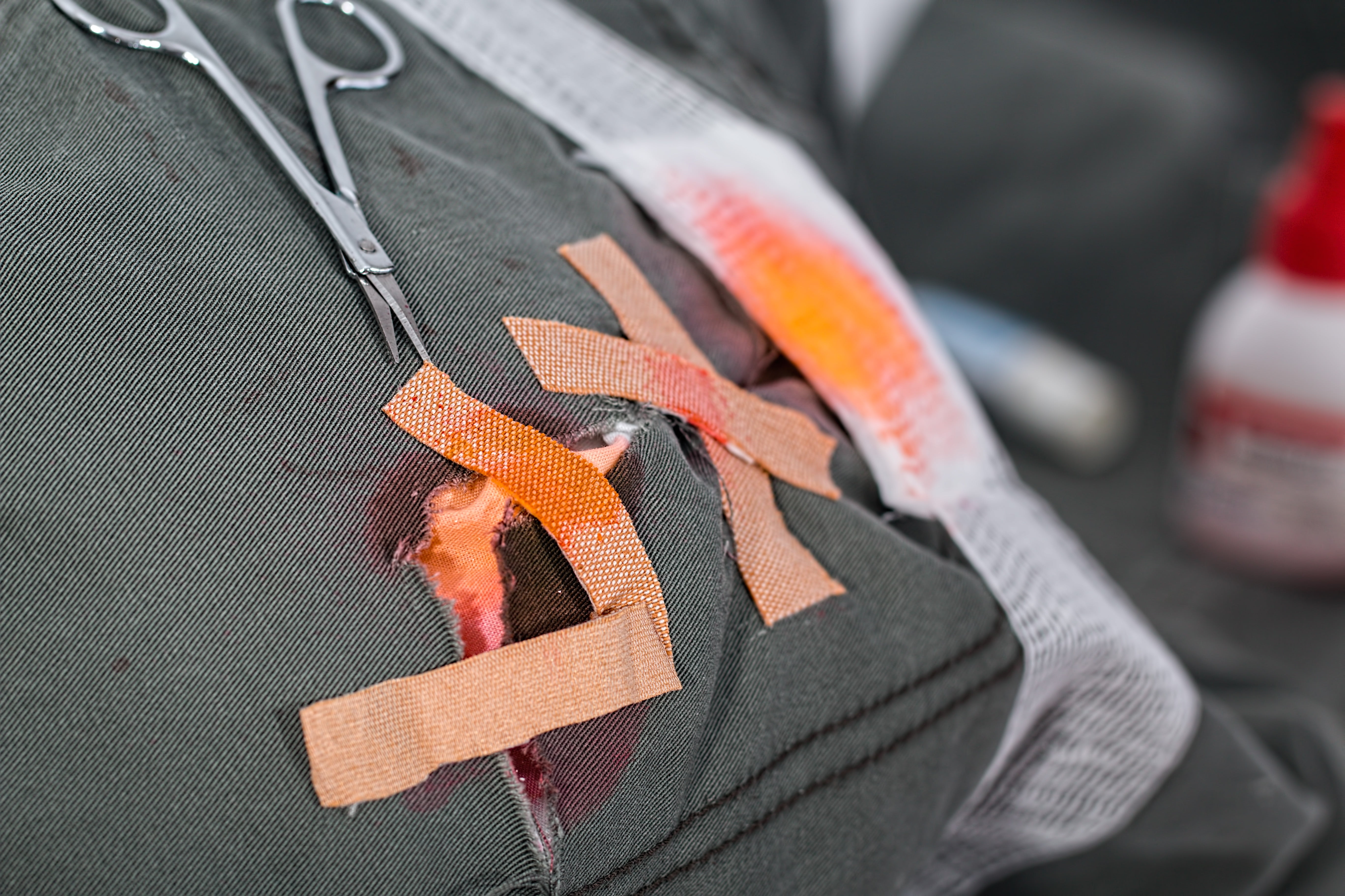 hurt, mercurochrome, bandage, orange color, merthiolate, archival, scissors, hanging, injury, band-aid, 5K, emergency, elastoplast, people, close, trauma, HD Wallpaper