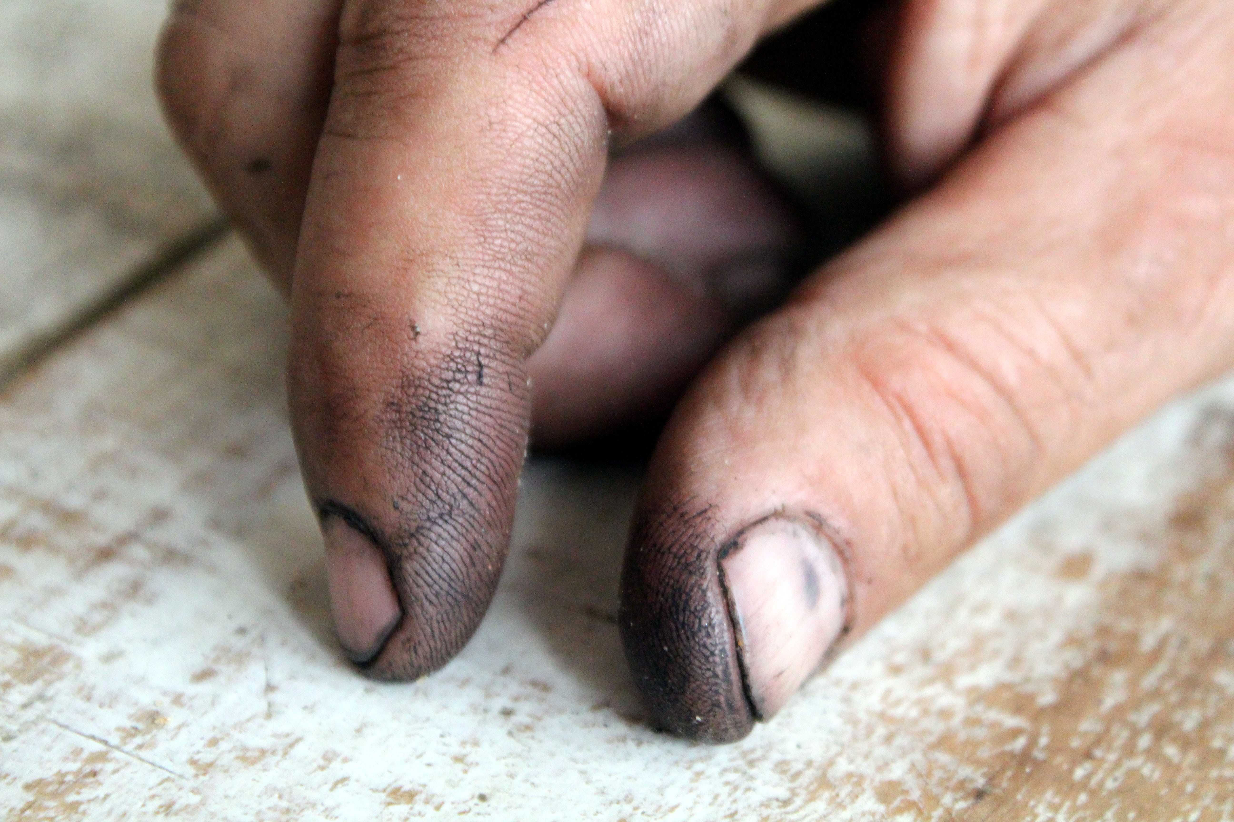 activity, work, healthcare and medicine, body part, person, repair, human hand, adult, view, s, people, resourceful, mechanic, close-up, unhygienic, men, HD Wallpaper