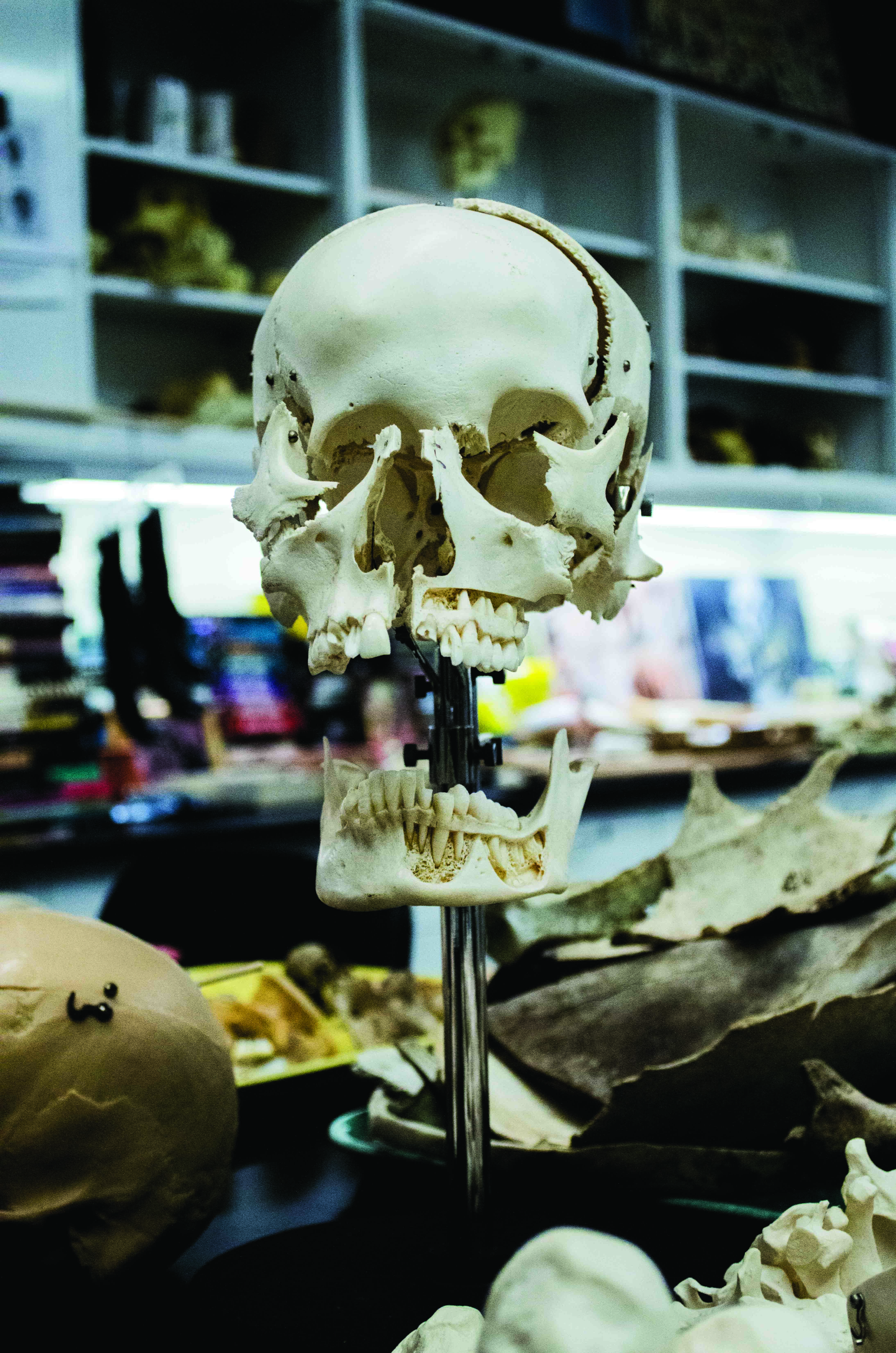 white, sweet food, skull, human skeleton, forensic, teeth, indoors, still life, lab, human, creativity, exploded skull, 5K, dead, stand, death, bone, no people, Phone HD Wallpaper