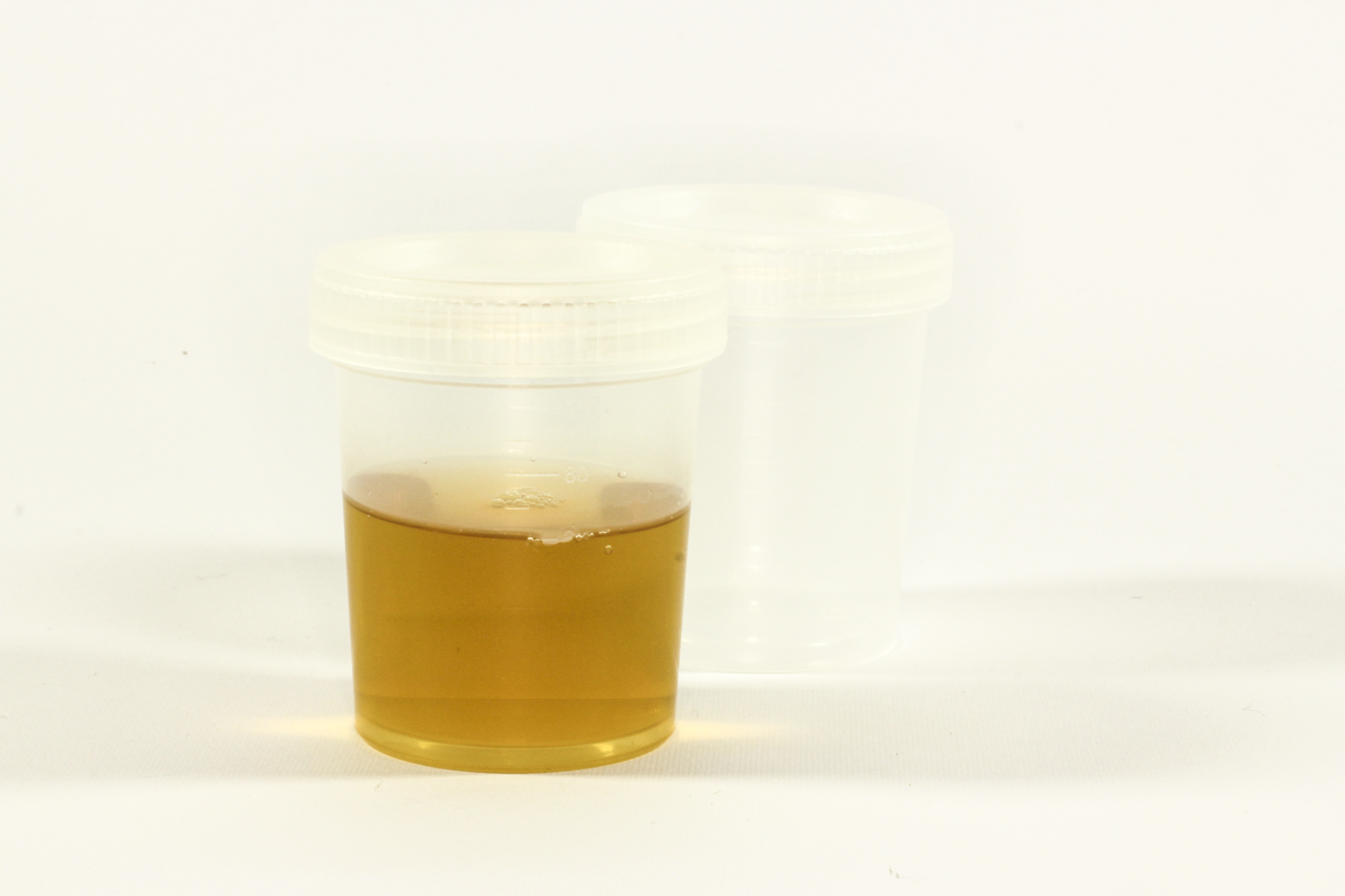 cut out, yellow, drink, medical, inflammation, refreshment, food and drink, research, studio shot, tube, container, urine container, white background, 4K, HD Wallpaper