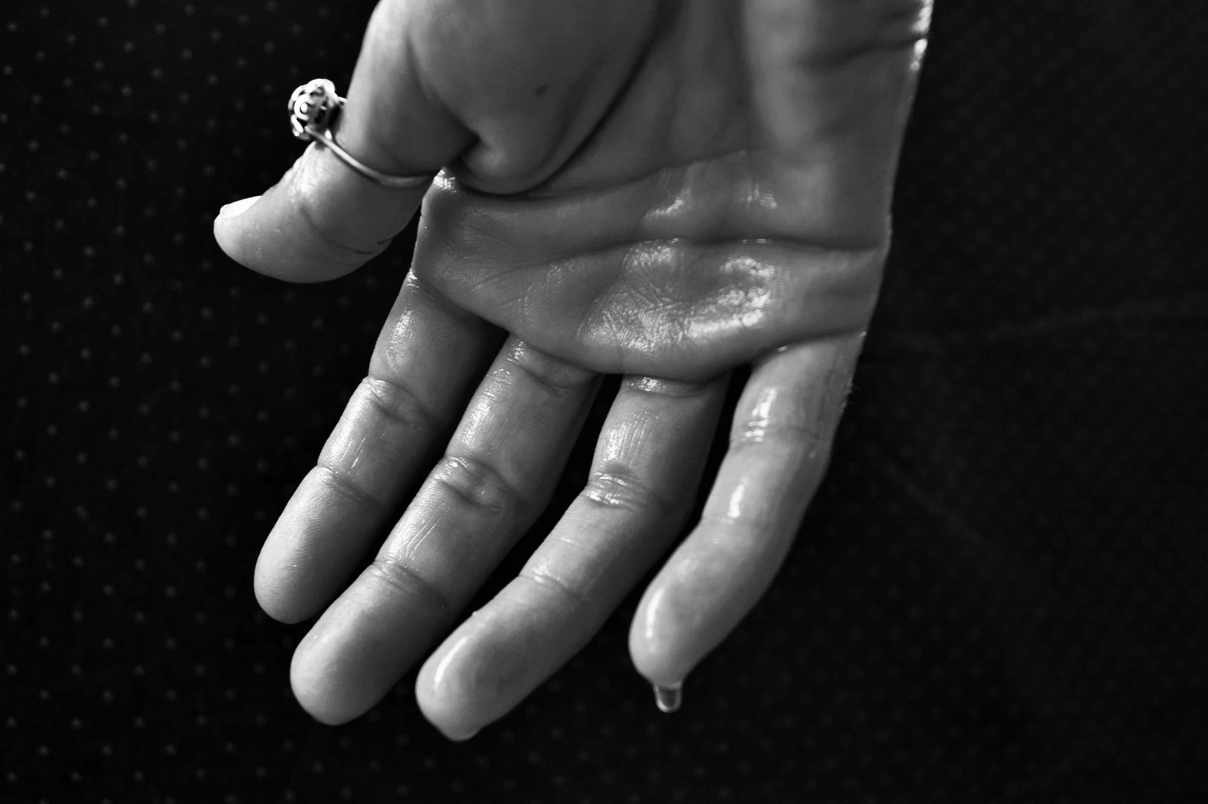 sweat drenched, close-up, no fever, studio shot, grayscale, jewelry, s, syndrome, adult, grondande, 4K, human finger, photography, nail, sweat, hyperhidrosis, HD Wallpaper