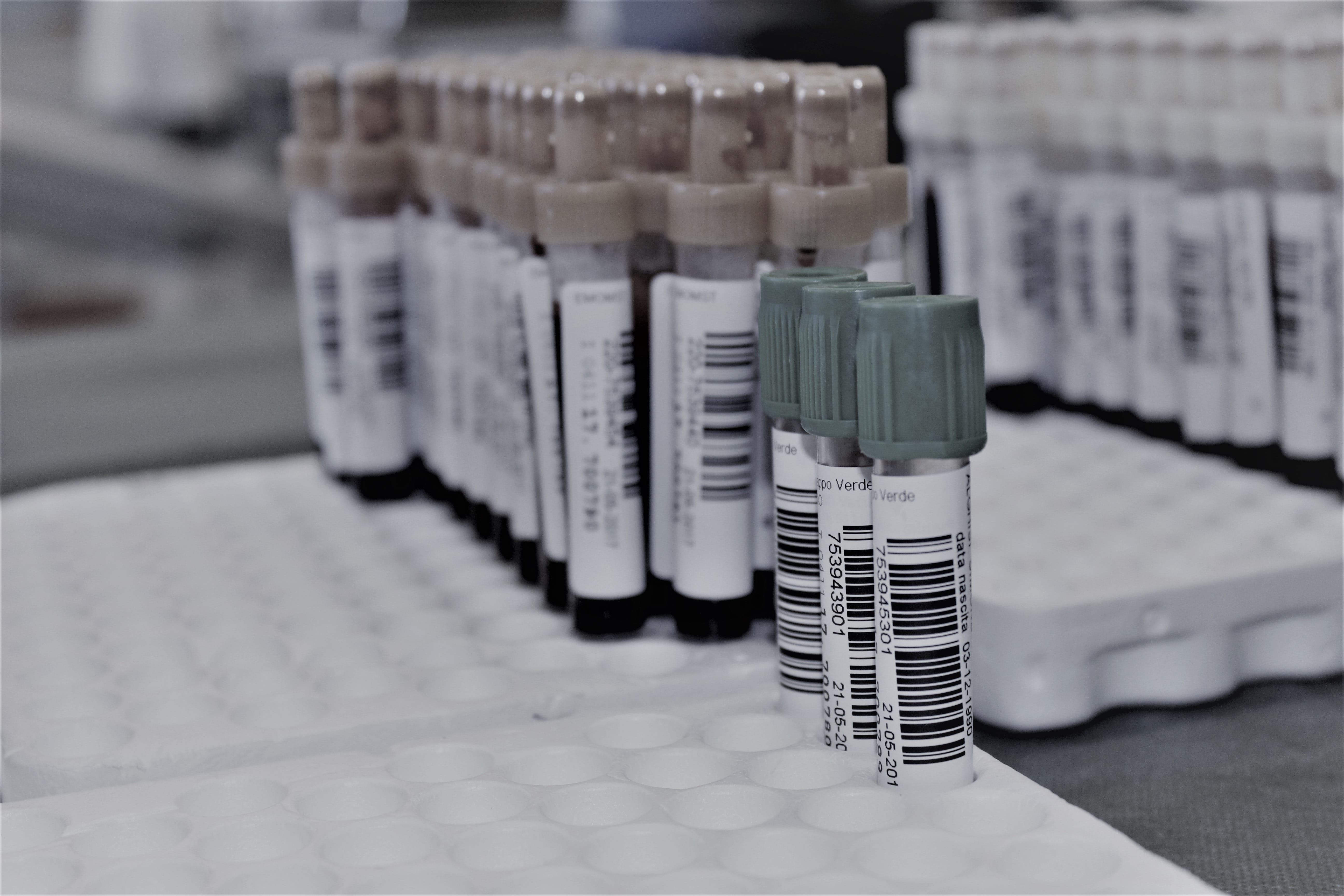 5K, focus on foreground, technology, arrangement, italy, test tube rack, research, indoors, close-up, pain, stack, scientific experiment, science, donors, HD Wallpaper