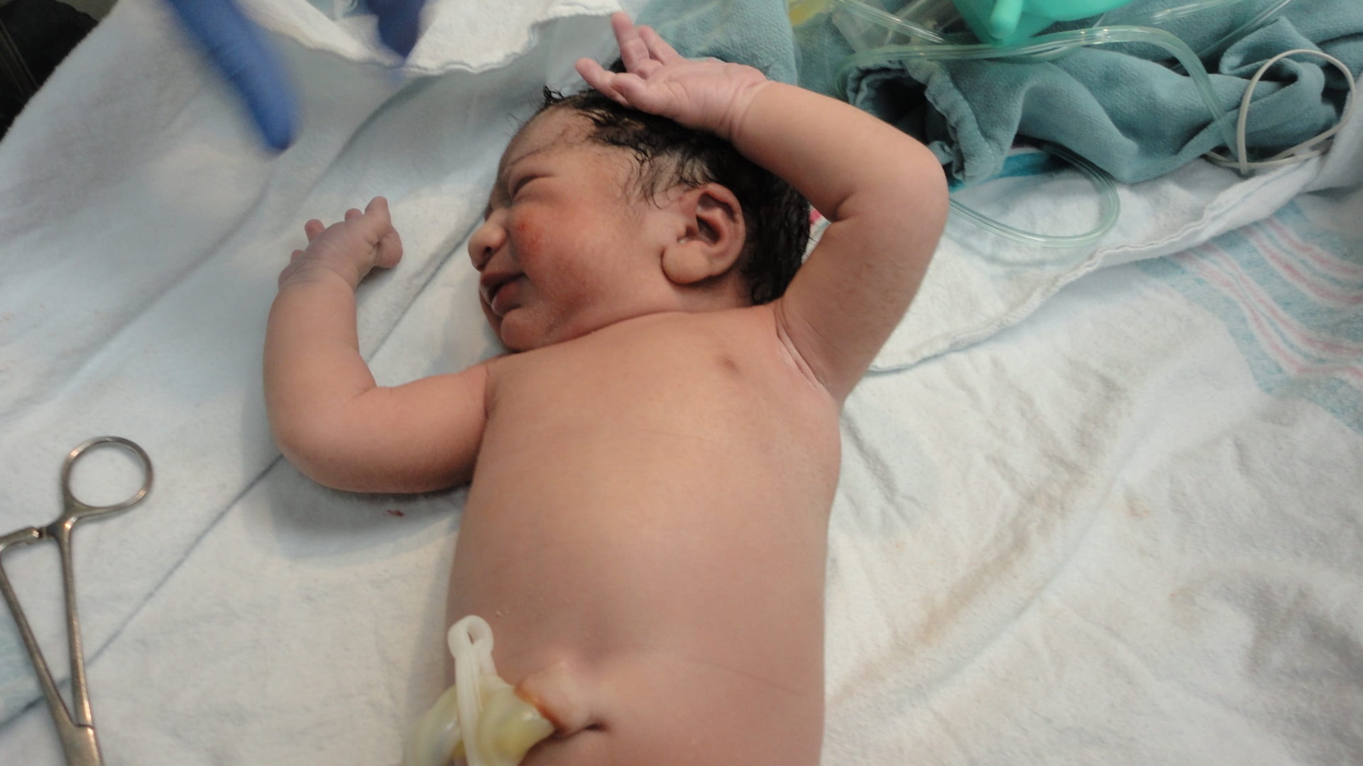 medical, newborn baby, new baby, delivery, healthy baby, relaxation, lying down, indoors, eyes closed, one person, born, newborn, care, chest, 1080P, birth, HD Wallpaper