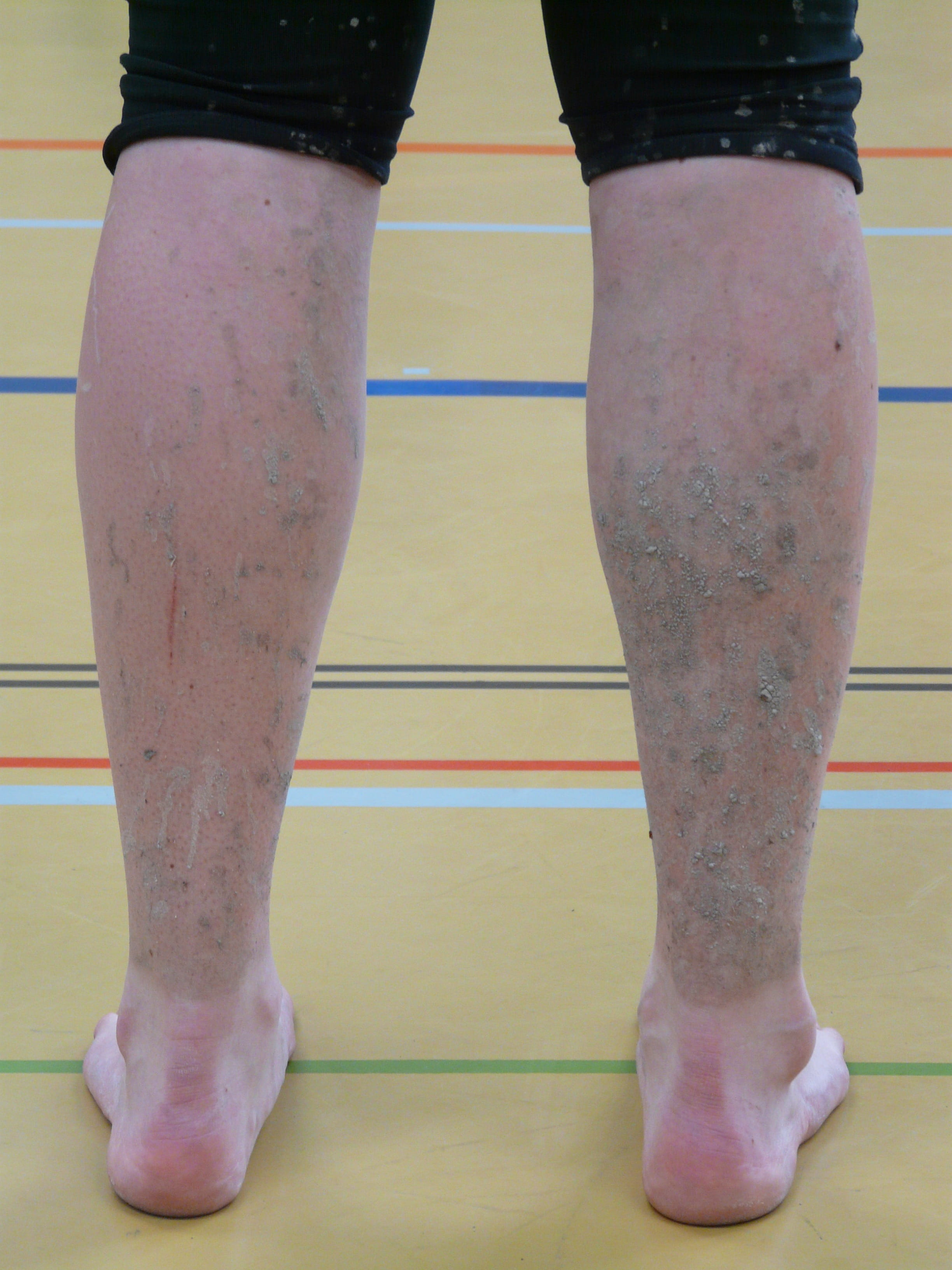 sport, indoors, Run, day, human limb, mud, Dirty, shoe, limb, close-up, Feet, human Leg, sock, adult, human Foot, physical injury, real people, misfortune, Phone HD Wallpaper