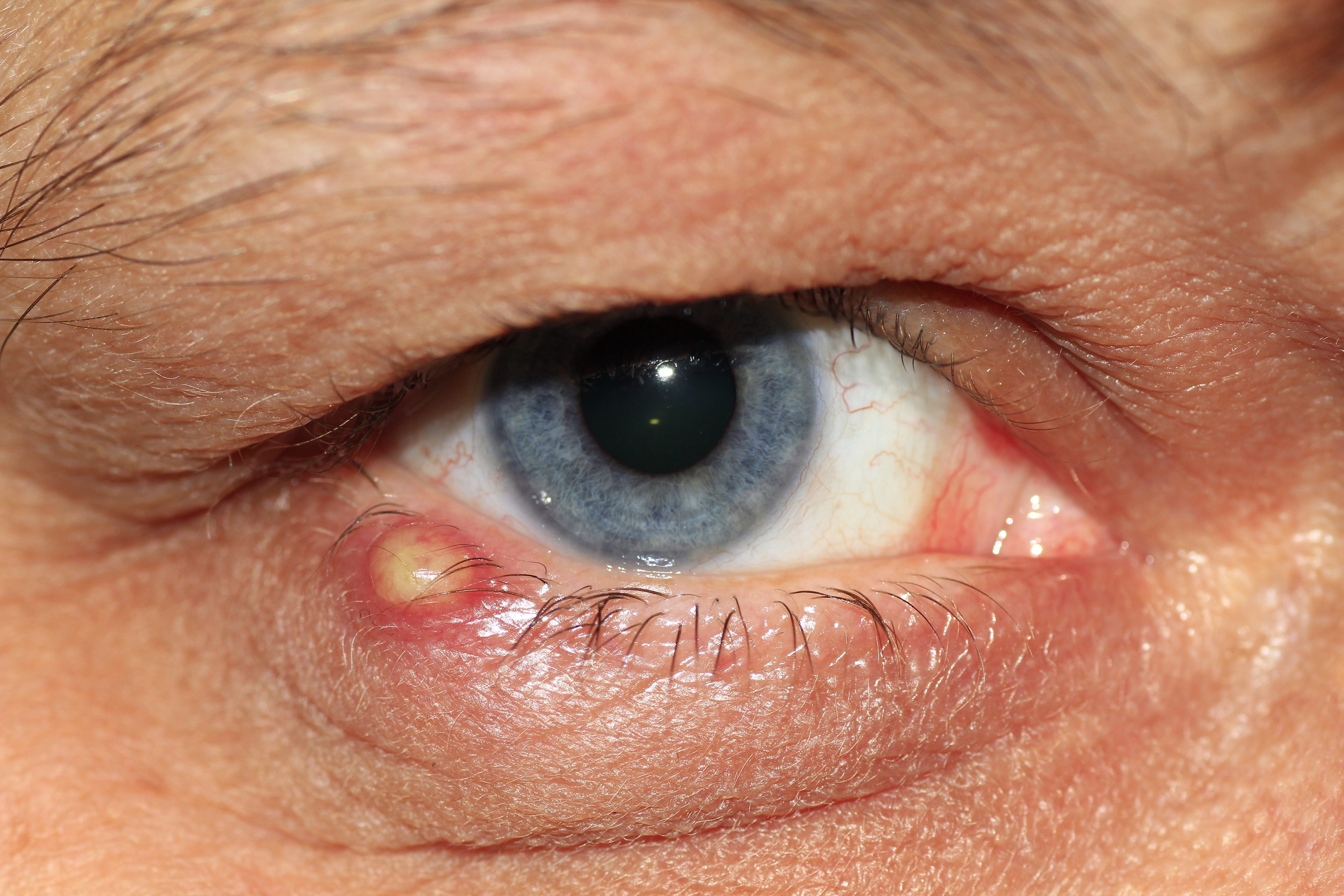 body part, human face, iris - eye, person, eyelashes, men, barley grain, closeup, 5K, skin, right, extreme close-up, iris, photo, eyeball, bacterial infection, HD Wallpaper