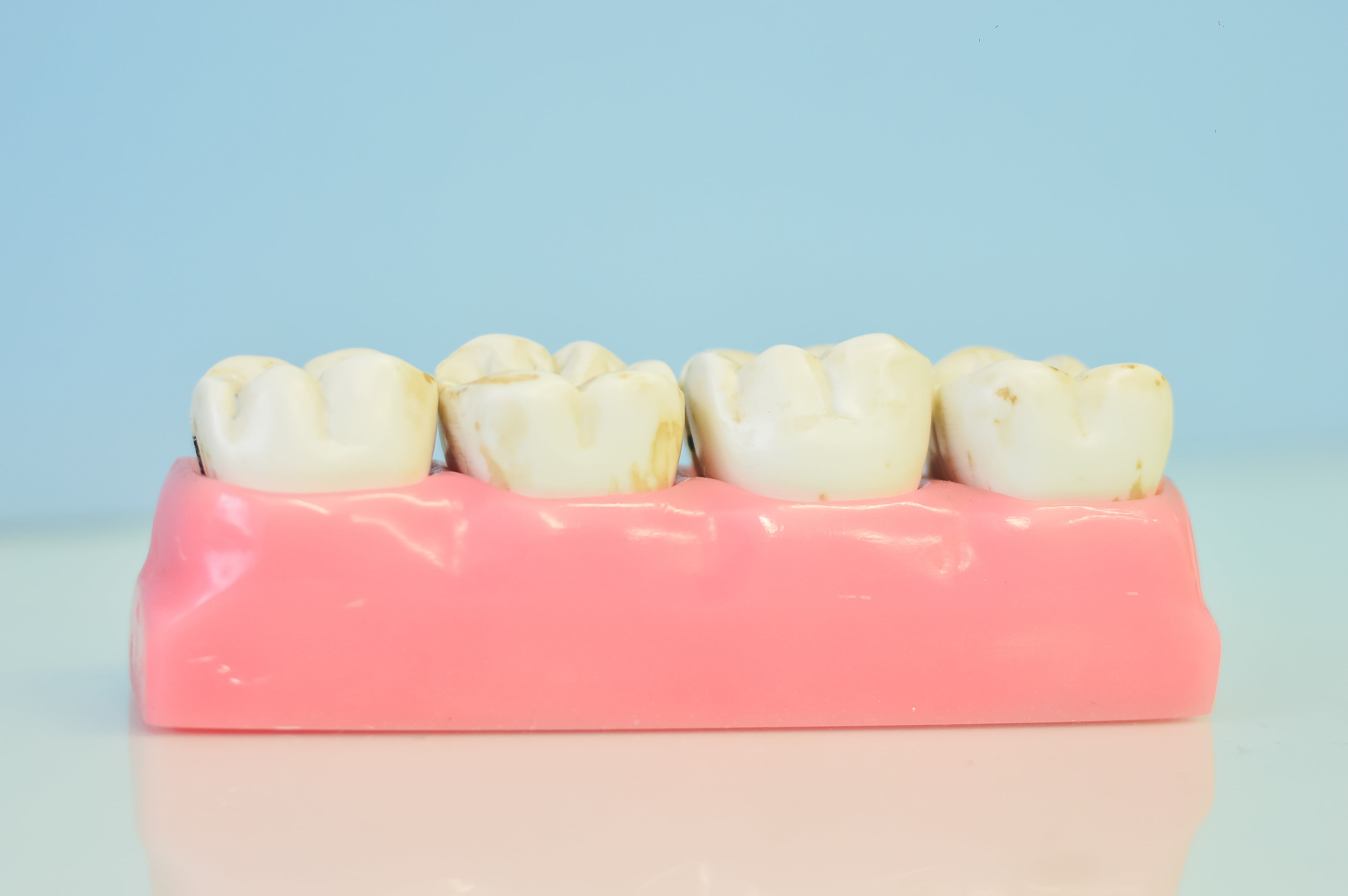 denture, no people, 4K, close-up, dairy product, dental office, in a row, pink color, colored background, indulgence, food and drink, macromodelo of teeth, HD Wallpaper