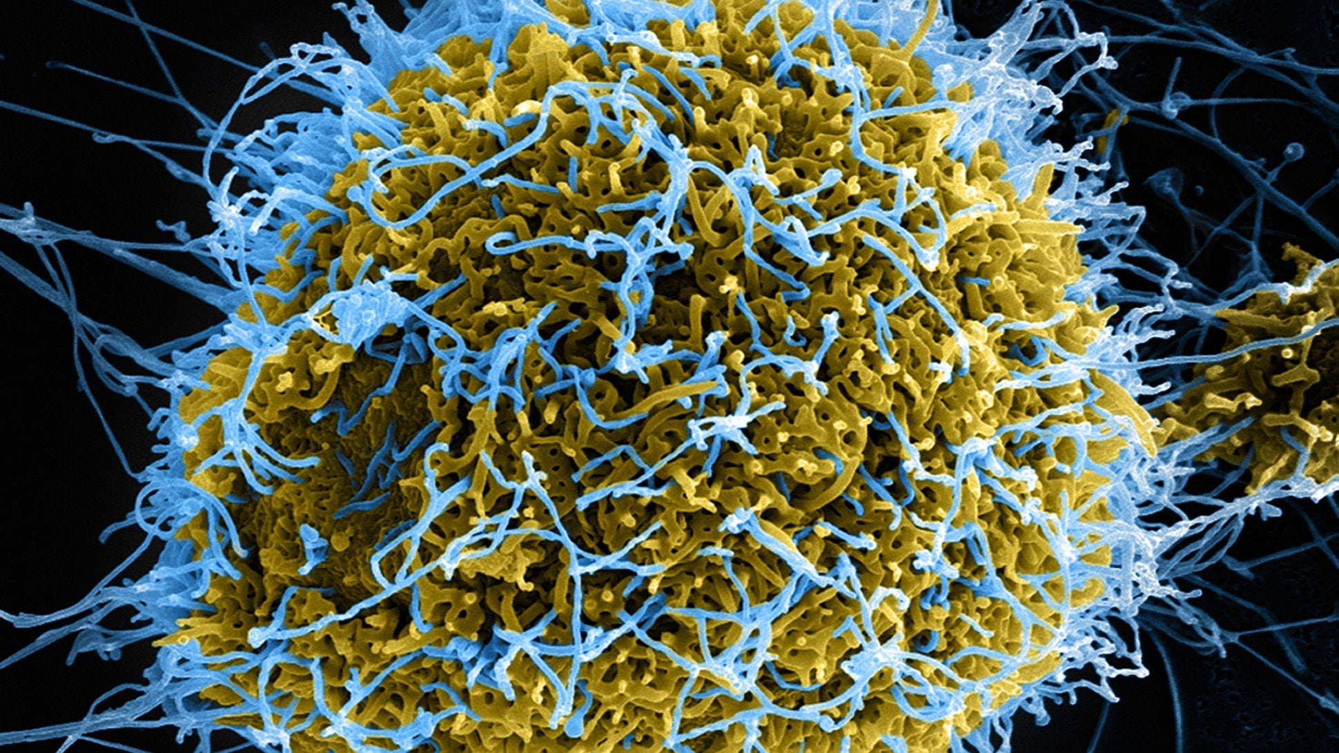 horror, Medical, Virus, Disease, 1080P, Dark, Ebola, HD Wallpaper