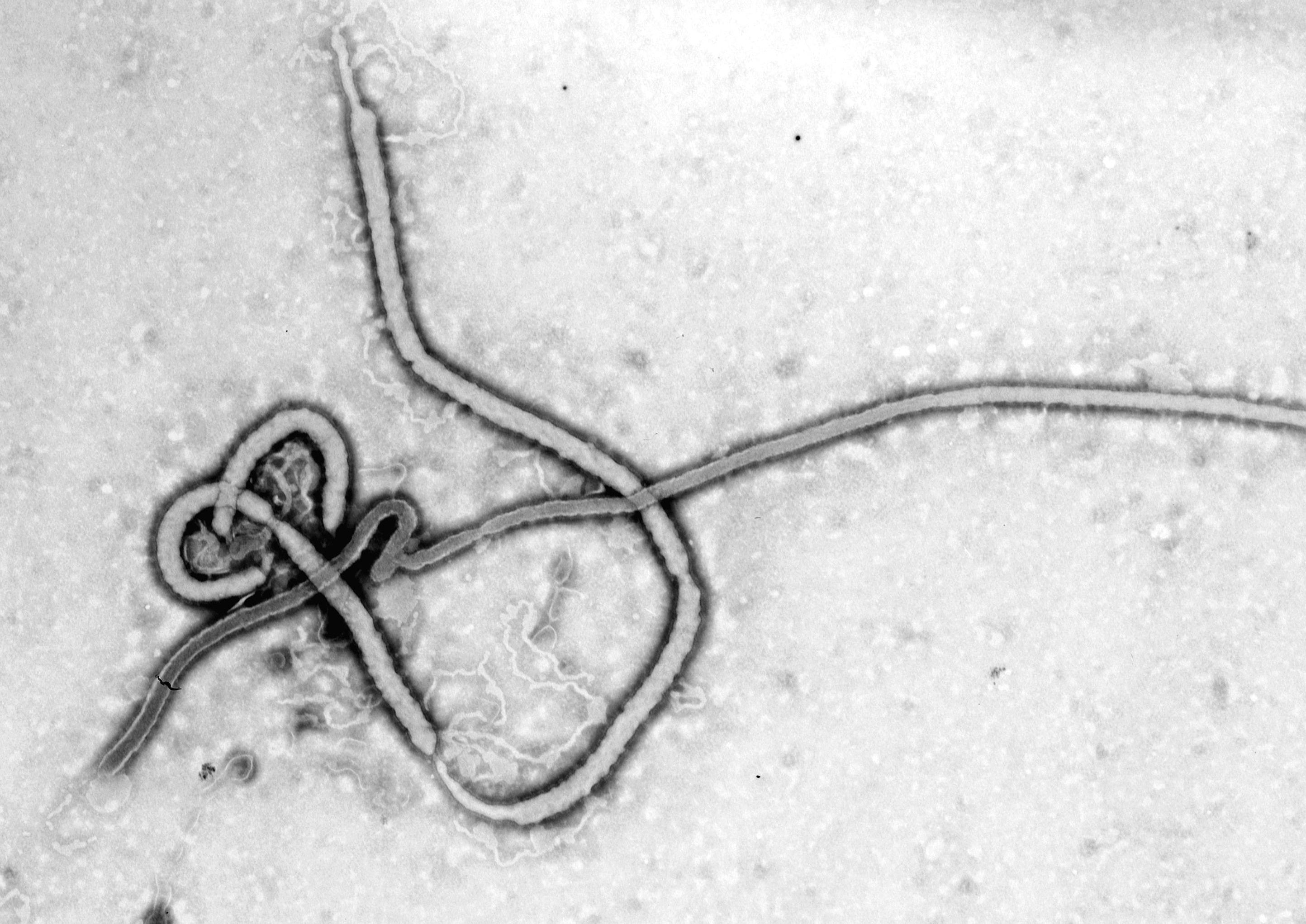 Disease, Dark, horror, Ebola, Medical, 2K, Virus, HD Wallpaper