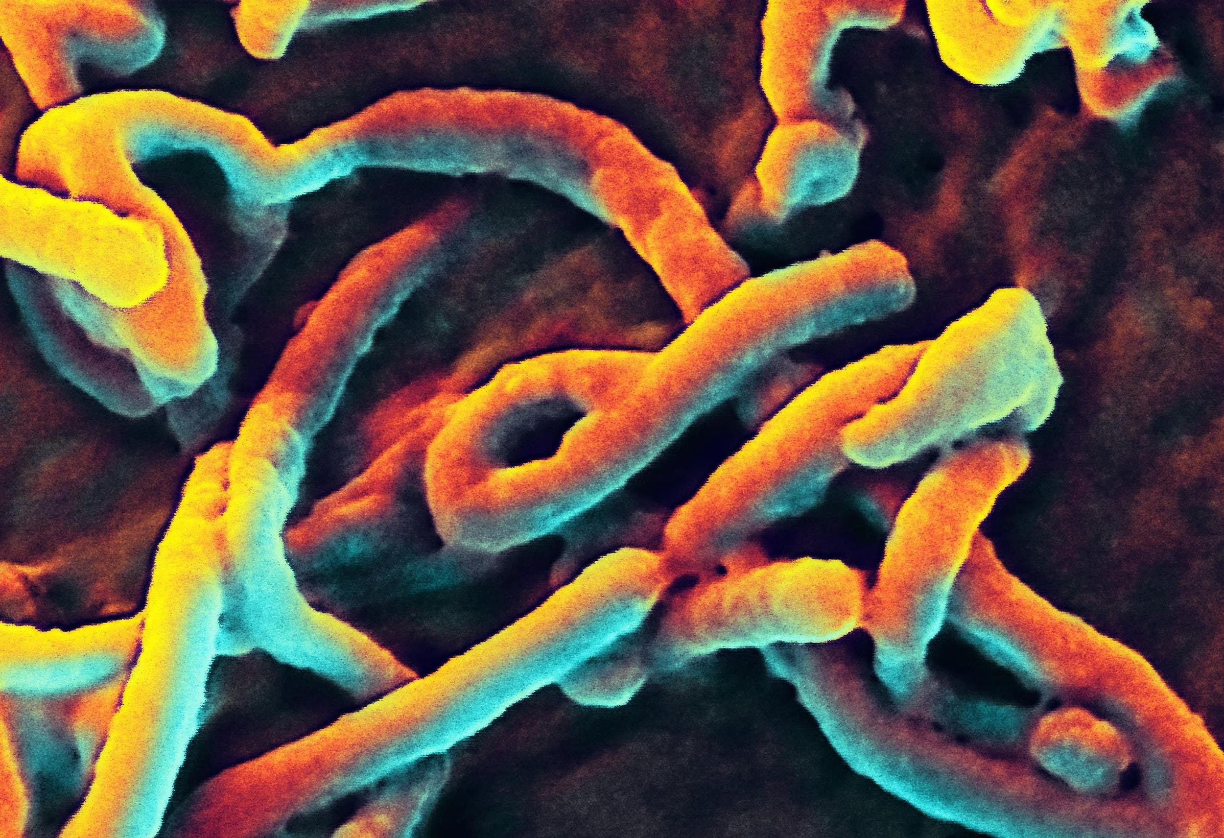 Disease, 1080P, Medical, horror, Virus, Ebola, Dark, HD Wallpaper