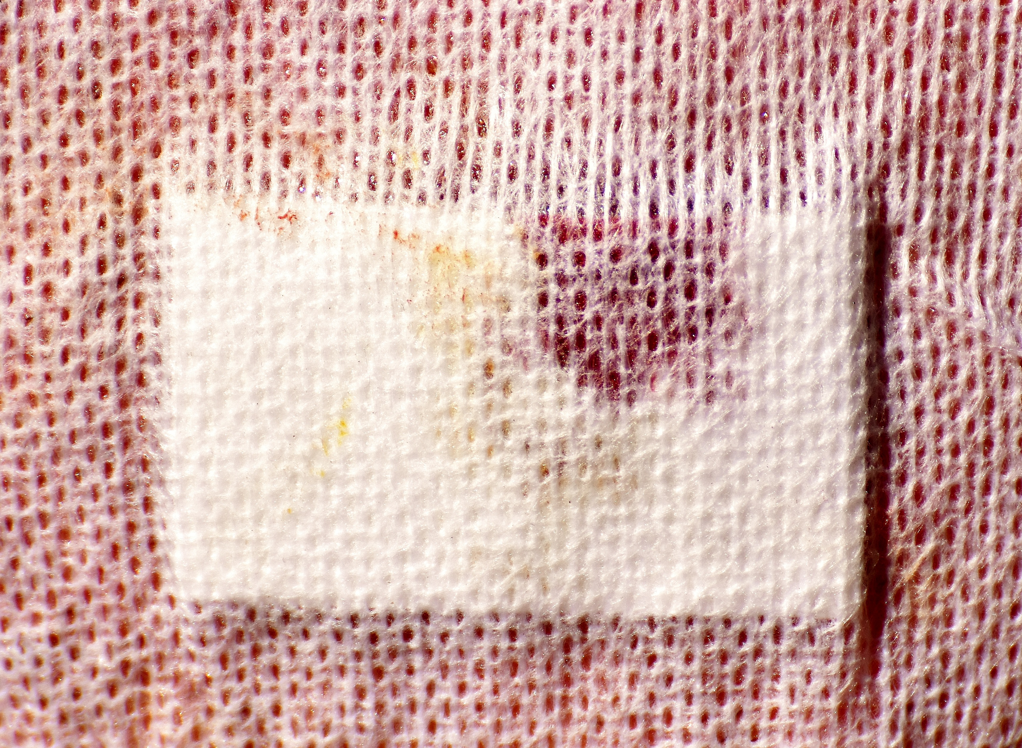 pattern, obsolete, red, shape, textured, extreme close-up, backgrounds, pain, healing, wound, old, retro styled, warm clothing, abstract, full frame, injury, HD Wallpaper