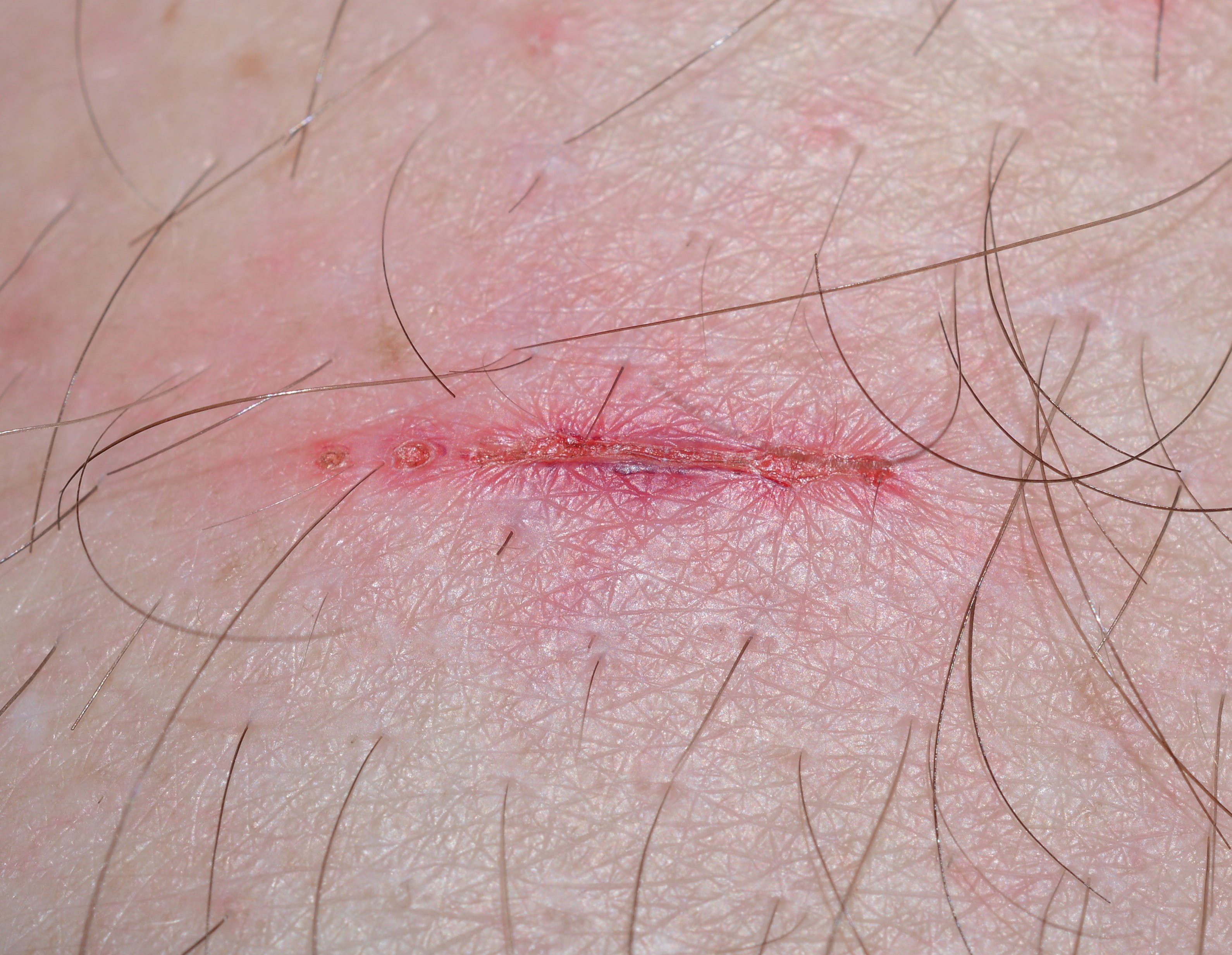 extreme close-up, 2K, skin, one person, human skin, physical injury, pink color, full frame, unrecognizable person, day, frisch, scratched, human hair, HD Wallpaper
