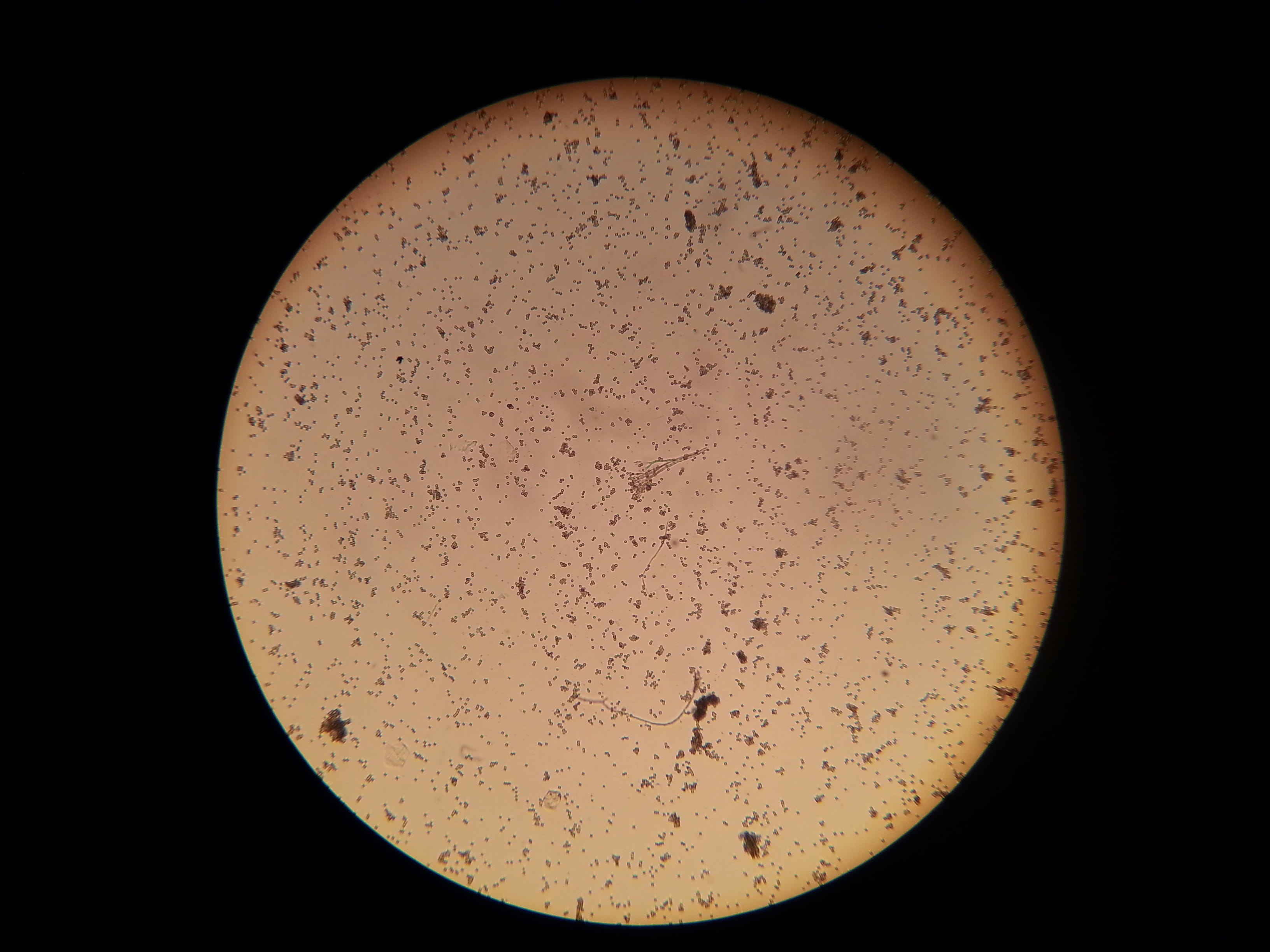 Image, microscopic image, optical instrument, microbiology, black background, research, Bacteria, no people, Microscope, education, shape, indoors, Microscopic, HD Wallpaper
