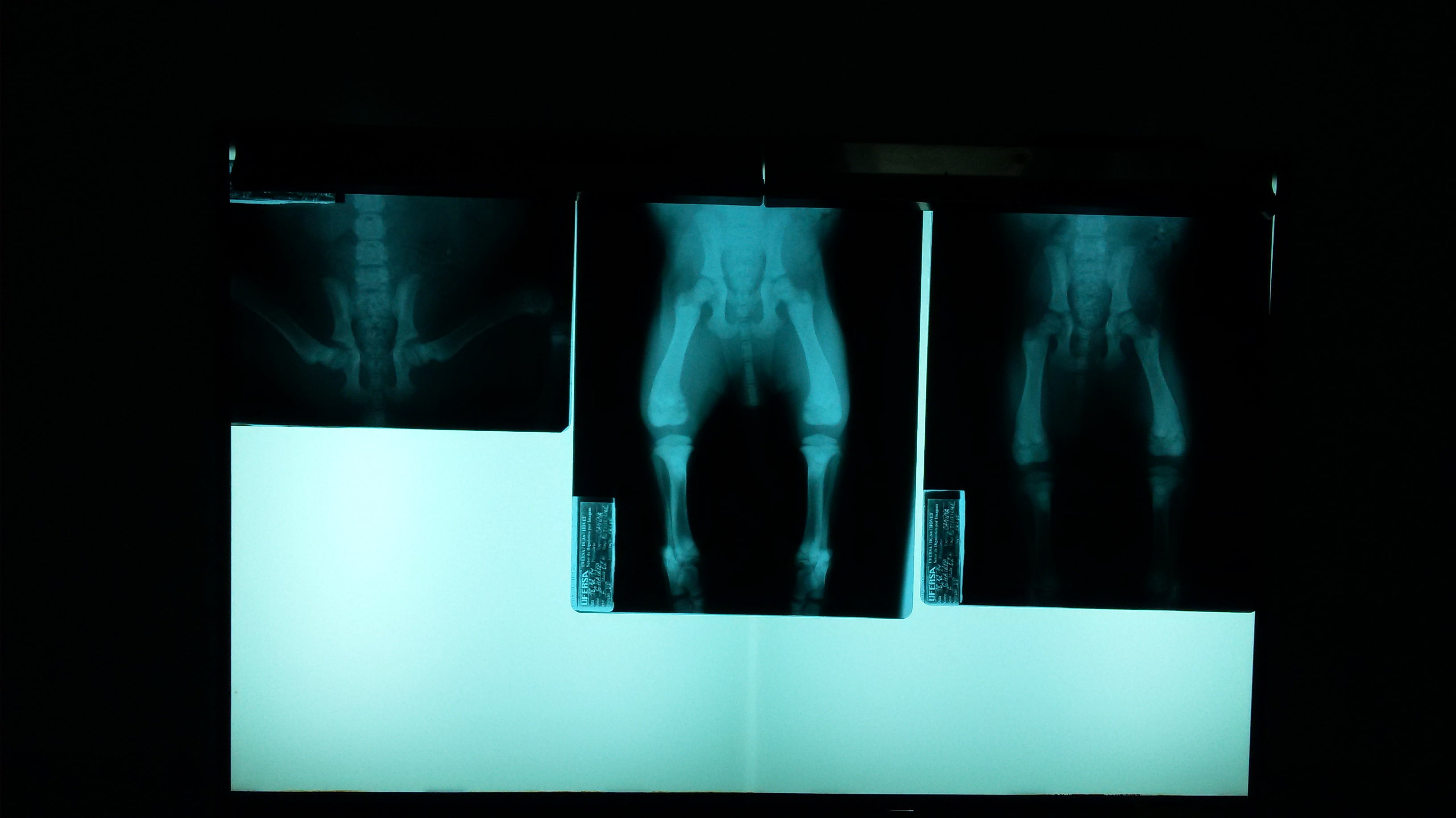 radiologist, x-ray image, anatomy, illuminated, healthcare and medicine, people, fracture, human limb, dark, human bone, hospital, bone, close-up, medical x-ray, HD Wallpaper