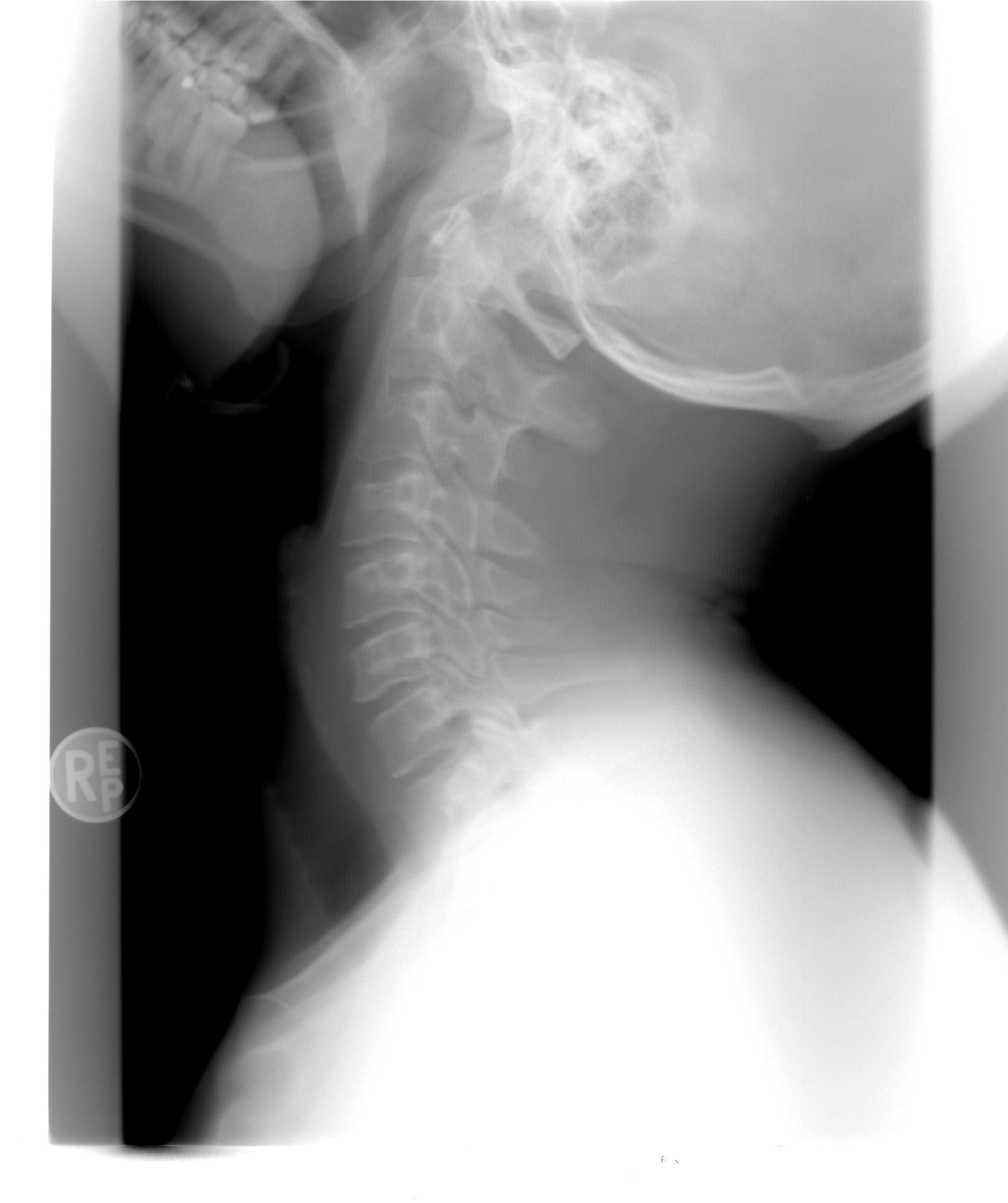 women, healthcare, human bone, x, skeleton, human body part, ray, close-up, adult, body part, healthcare and medicine, anatomy, indoors, injury, 1080P, Phone HD Wallpaper