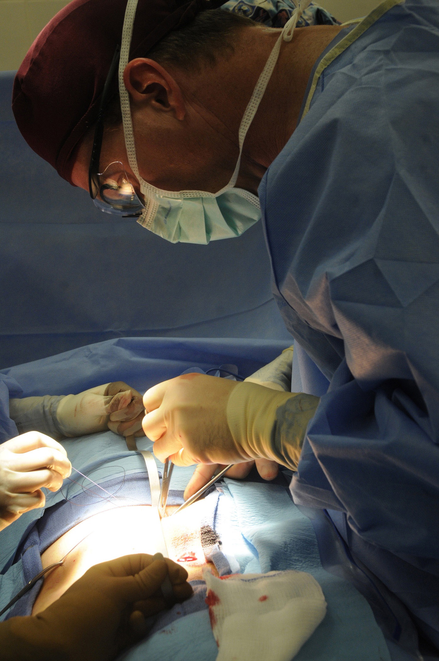 doctors, patient, table, surgical glove, expertise, holding, females, operation, surgeon, health, healthcare, treatment, real people, healthcare and medicine, Phone HD Wallpaper