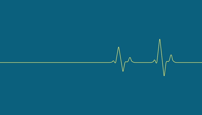 digital art, minimalism, simple background, heartbeat, blue background, medicine, simple, abstract, lines, pulse