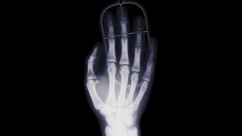 arm, x-ray, bone, computer mouse, 4k