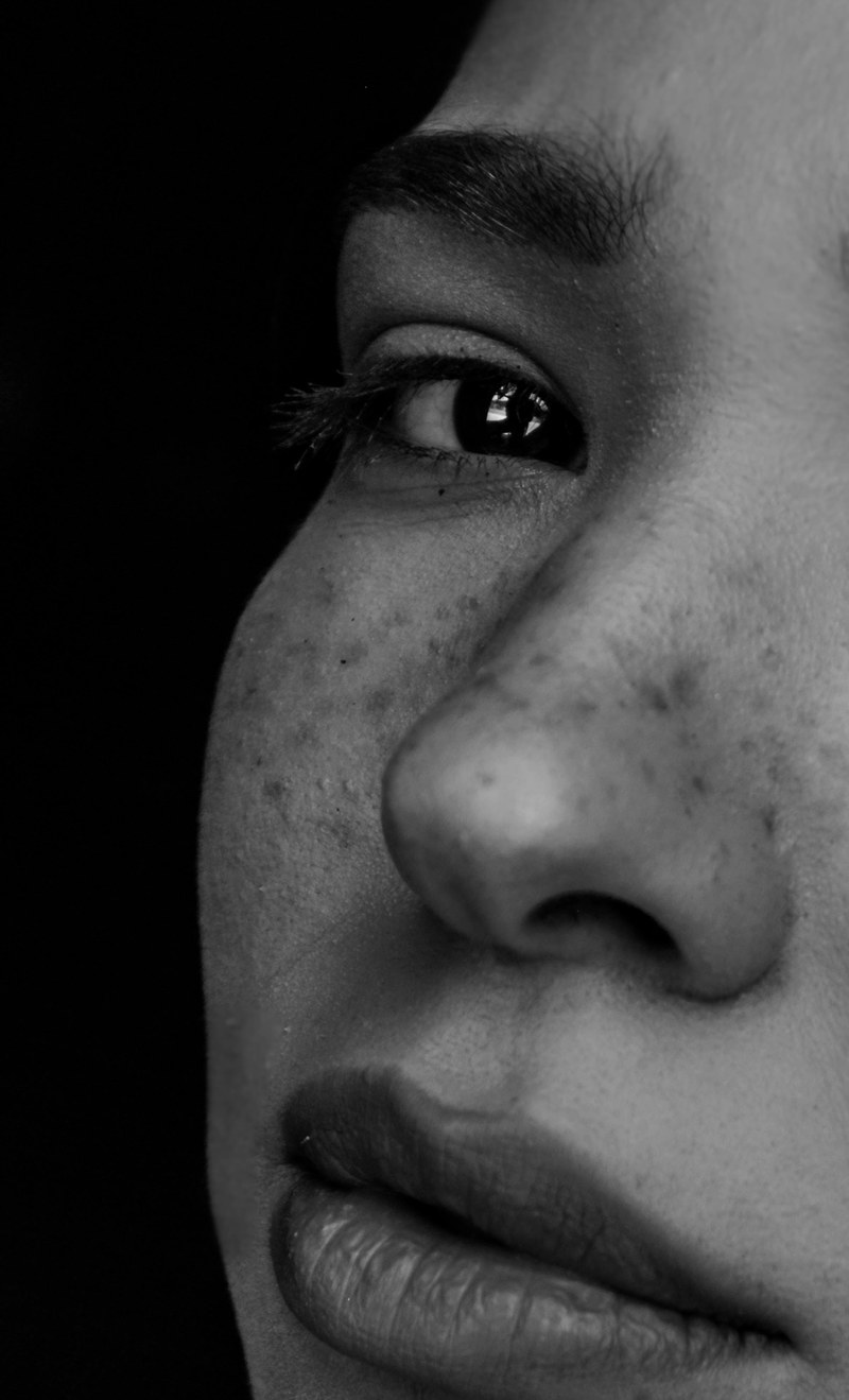freckles 4k