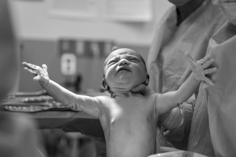 baby newborn surgeon and hospital 4k