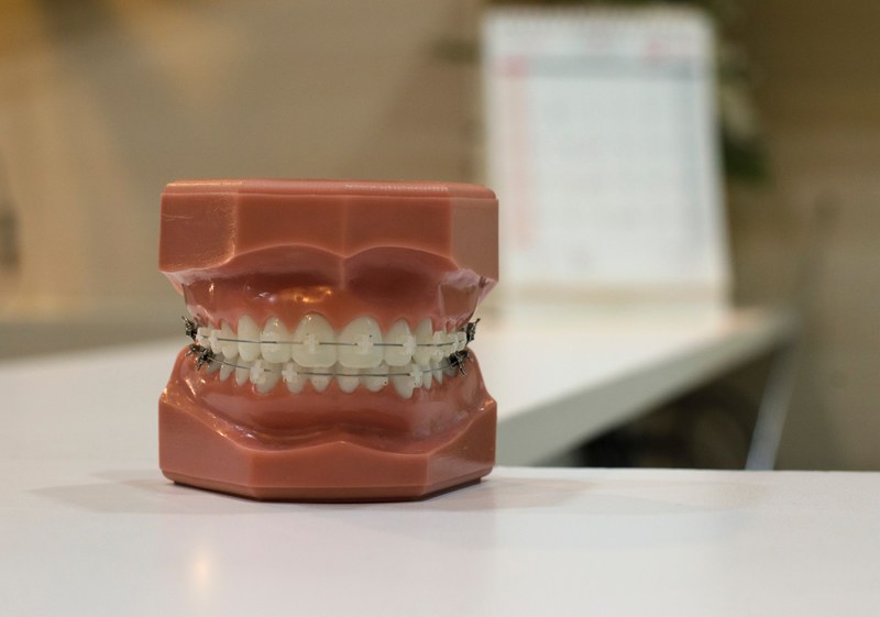 brace dentist teeth and wire 4k