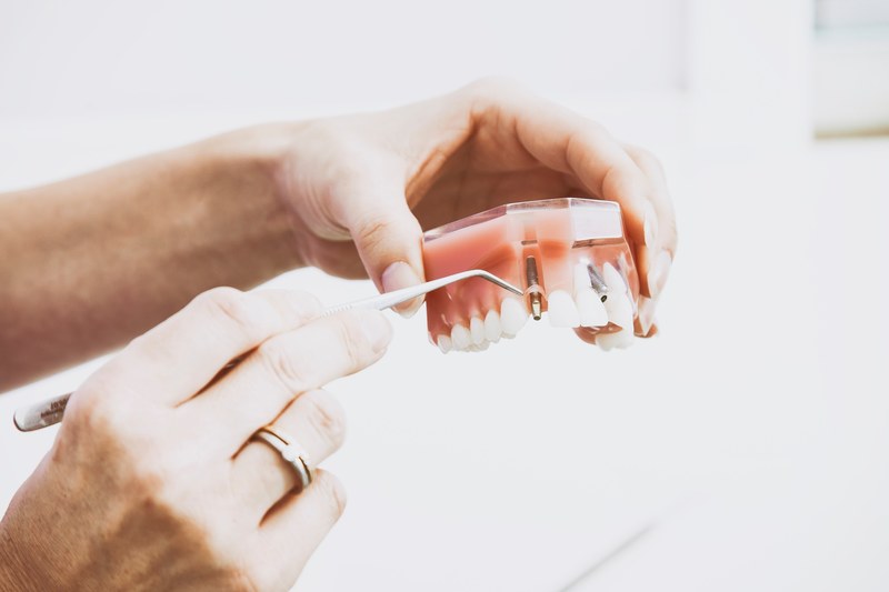 a dentist holding a fake set of teeth in her hands showing how implants work, dental implants 4k