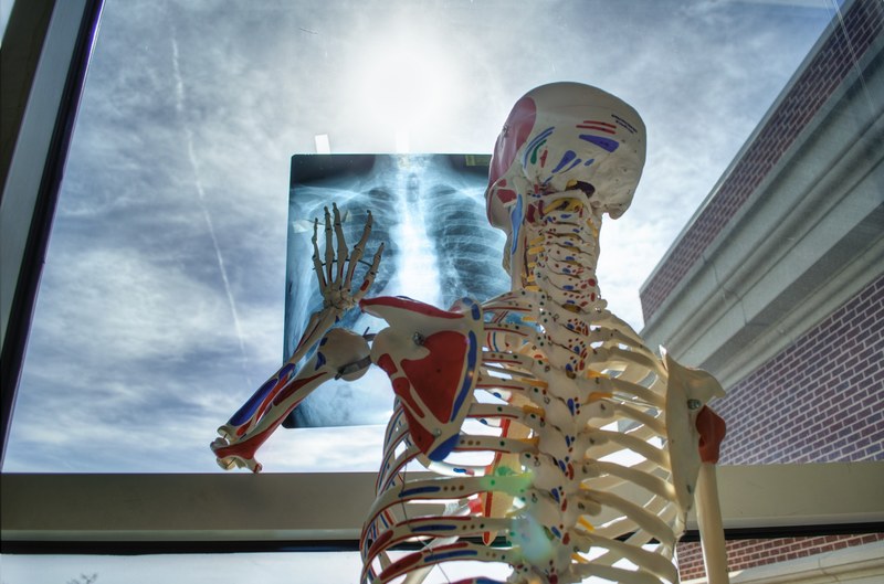 a skeleton touching an x ray picture, _skeleton xray 4k