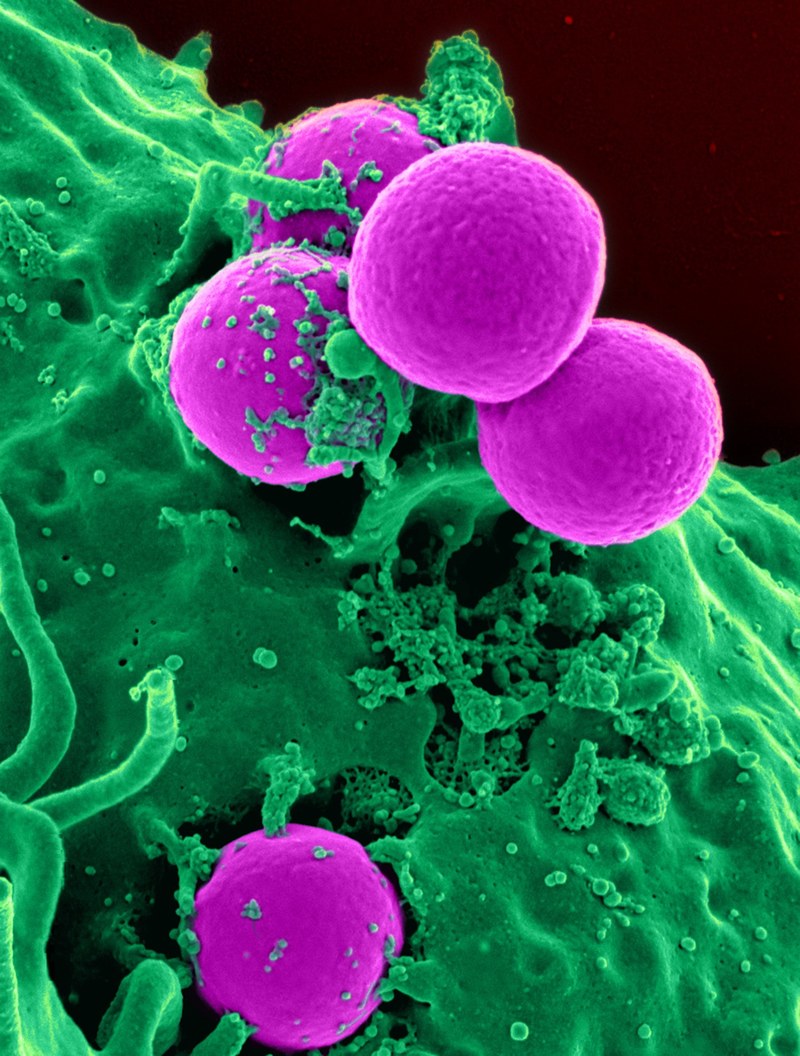 white blood cell cell blood cell blood human 4k