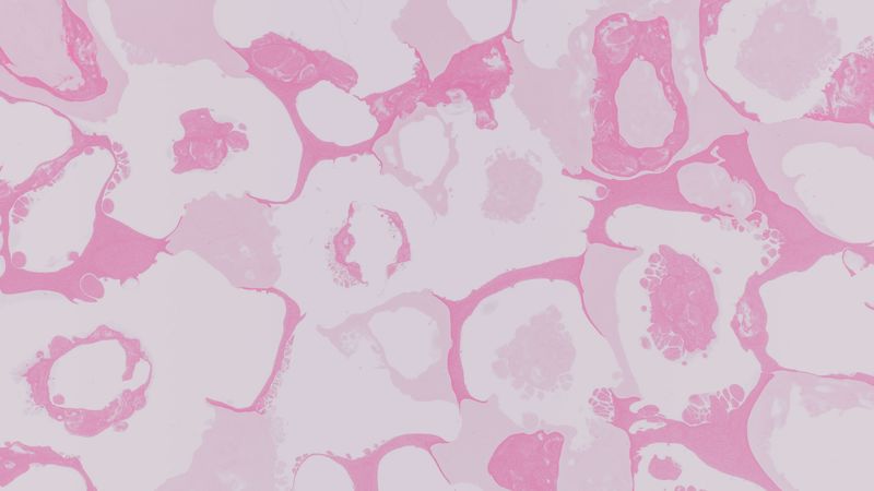 spots, circles, stains, abstraction, 4k
