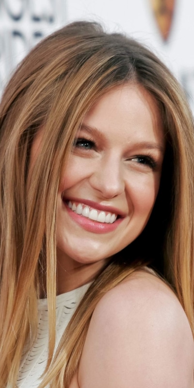 Celebrity Melissa Benoist, American, Actress, Face, Smile, Blonde, 1080x2160