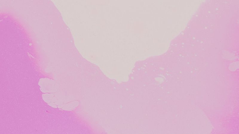 spots, abstraction, purple, 4k