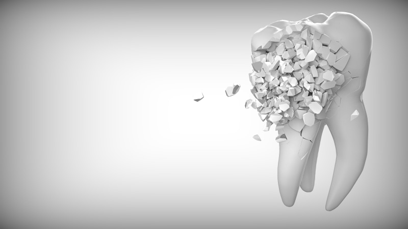 contemplation, three dimensional, body part, white, graphic, emotion, orthodontics, intelligence, silver colored, the background, fun, no people, dentistry