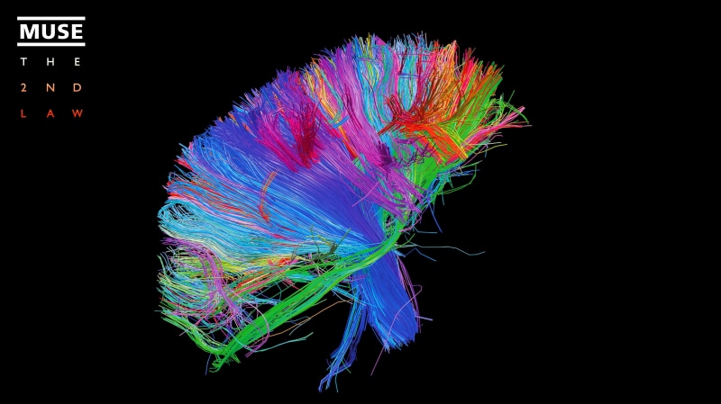 anatomy, studio shot, motion, hospital, brain, close-up, medical x-ray, medical exam, indoors, multicolored, copy space, multi colored, textile, black background