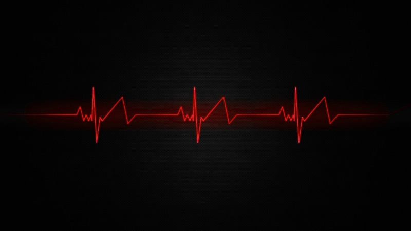 no people, pulse trace, close-up, abstract, texture, healthcare and medicine, indoors, technology, copy space, lines, blue, graph, minimalism, diagram