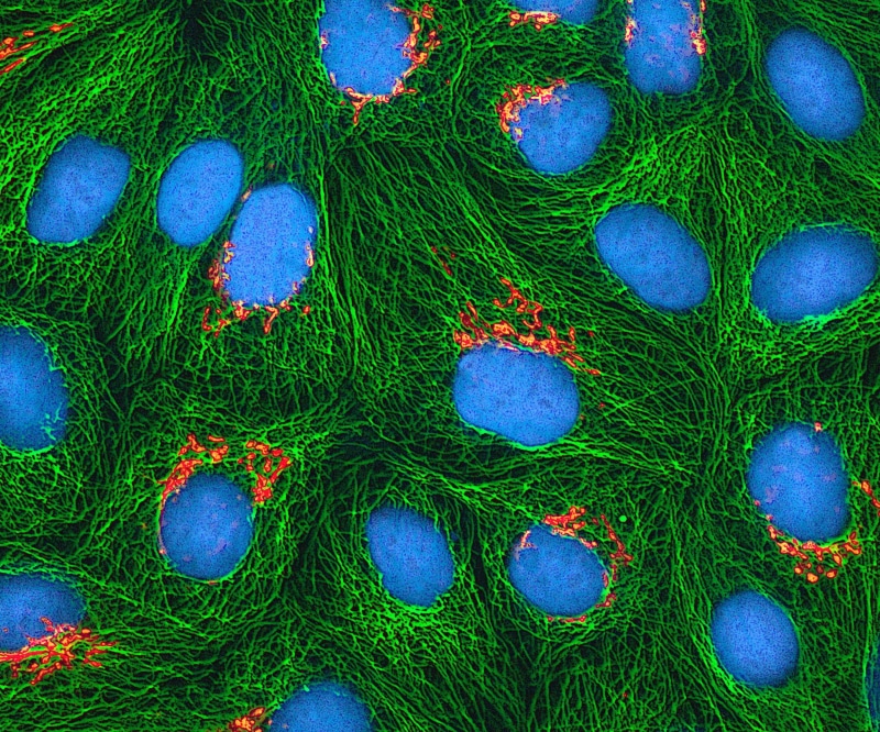 multi colored, directly above, plant, blue, nature, pattern, land, fishing industry, no people, textured, stained, hela cells, backgrounds, electron microscope