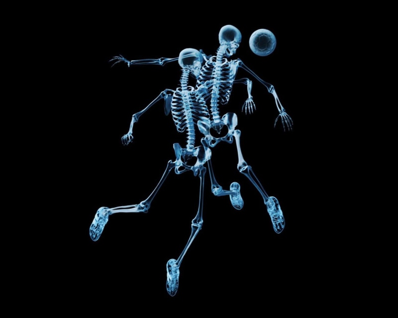 illness, joint - Body Part, skeletons, human Vertebra, healthcare And Medicine, human Bone, connection, nature, the Human Body, people, physical Injury