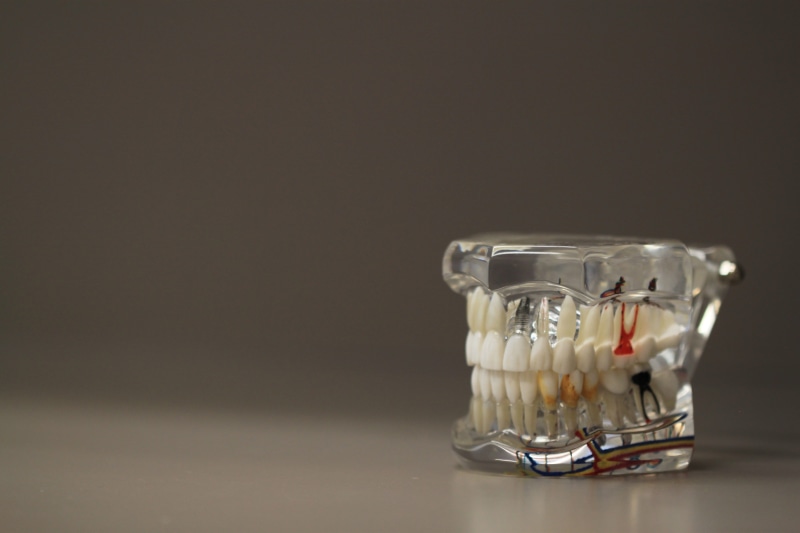 copy space, container, dentistry, close-up, oral, studio shot, dental health, glass - material, single object, black background, still life, healthcare and medicine