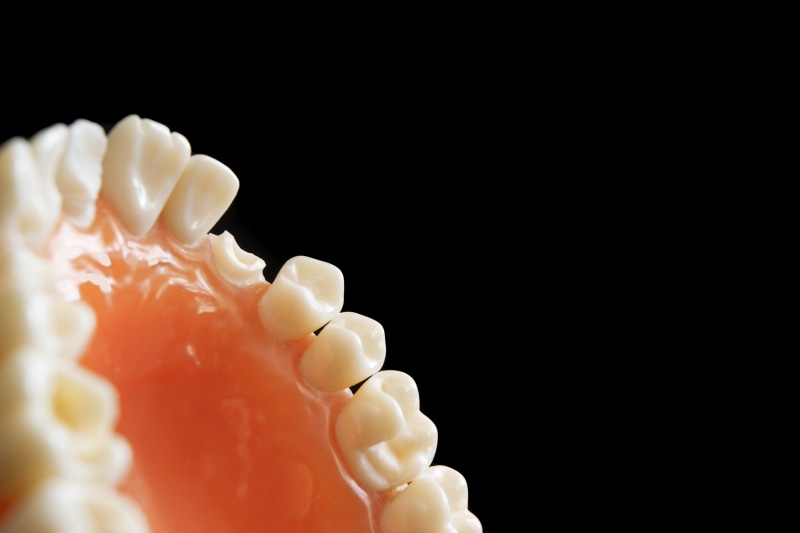 cut out, nature, food and drink, orthodontics, close-up, black background, splashing, selective focus, 5K, dentistry, still life, white color, motion