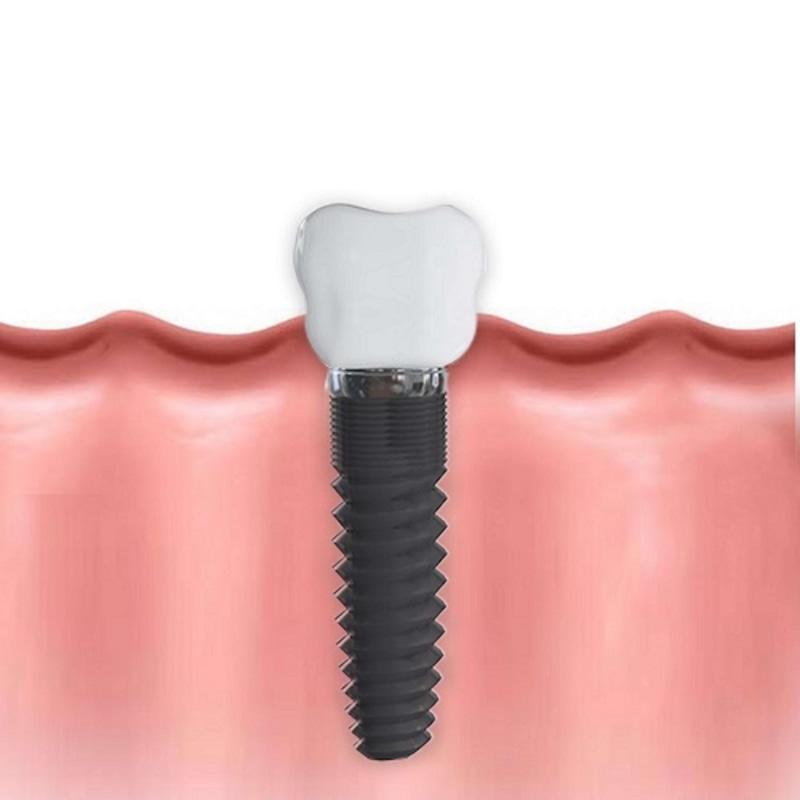 tooth, 4K, pink color, work tool, industry, dental, white background, metal, extreme close-up, teeth, strength, health, no people, black color, dentist