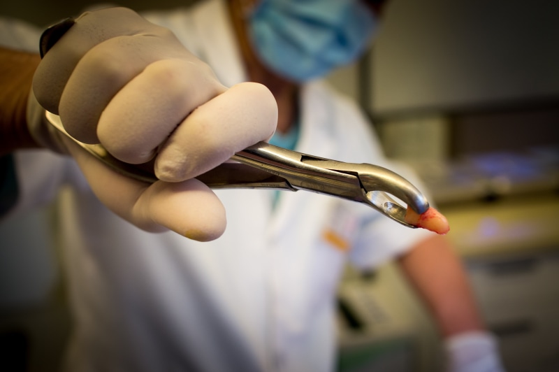 midsection, body part, dentist, indoors, teeth, pliers, focus on foreground, finger, protective glove, occupation, protective workwear, protection, one person