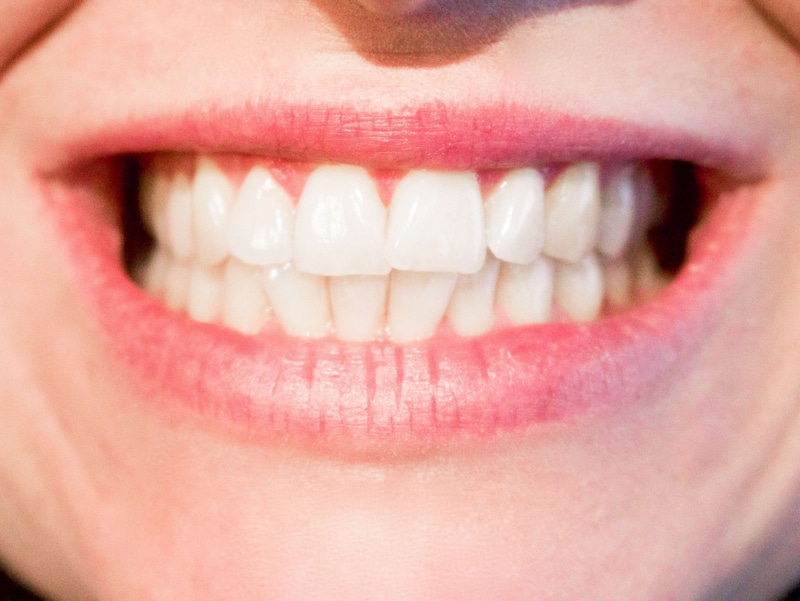 full frame, oral, professional, women, human mouth, mouth, smiling, skin, human body part, female, medicine, checkup, body part, care, medical, adult, health