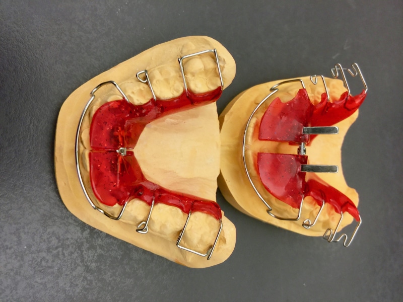 no people, freshness, plate, indoors, red, dentist, dentistry, slice, health, treatment, dental regulation, pepper, studio shot, table, healthy eating
