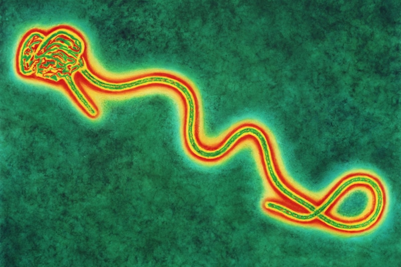 720P, horror, medical, virus, ebola, dark