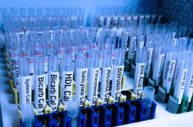 test-tube, science, medical research, water, equipment, no people, abundance, pharmaceutical, medicine, health, scientific experiment, drug, test, pharmacology