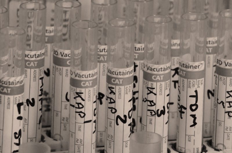 1080P, healthcare And Medicine, research, photo, medical, glassware, lab, chemistry, education, clinical, large group of objects, text, health, test, test-tube