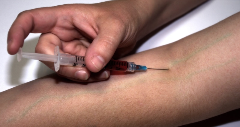 junkie, needle, liquid, human arm, close-up, body part, injecting, inject, indoors, human limb, hand, medical, 2K, sharp, sick, human body part, drugs