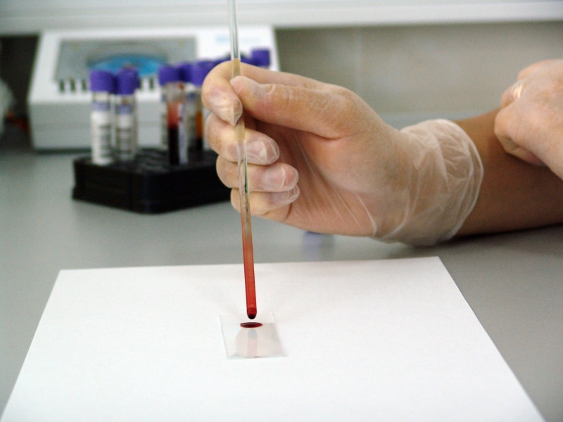 medicine, drop, glove, sample, analysis, finger, scientist, real people, tool, one person, person, hand, clear, analyzing, blood, medical, art and craft