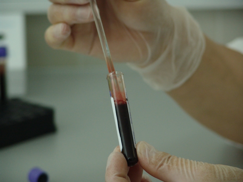 treatment, cell, specimen, lab, healthcare And Medicine, doctor, medical, scientific, biochemistry, immunology, brush, diagnose, sample, 2K, healthcare
