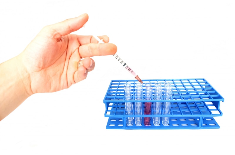 background, 1080P, pharmacy, medicine, cut out, human Hand, people, medical, close-up, health, tube, equipment, test tube, inserting, vaccine, treatment