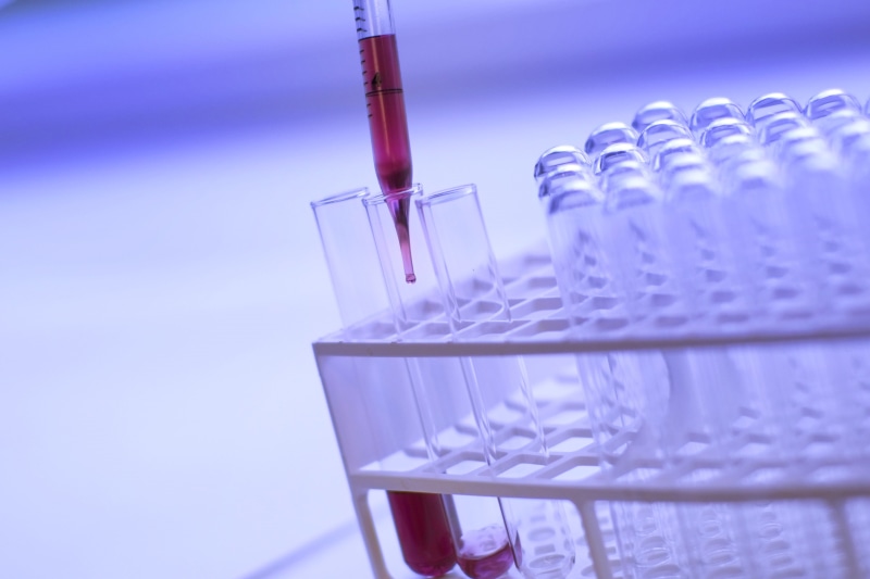 close, test Tube, analysis, to study, liquid, clear, indoors, medical test, laboratory glassware, science, chemistry, tray, 4K, treatment, close-up, chemical